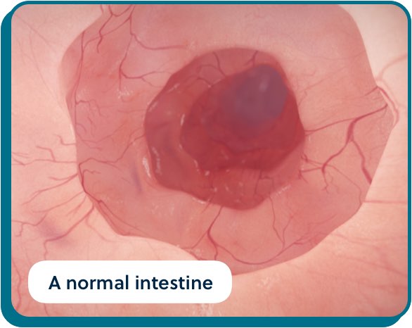 UC Inflammation bio images