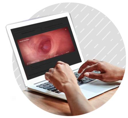 Person viewing a small intestine on a laptop
